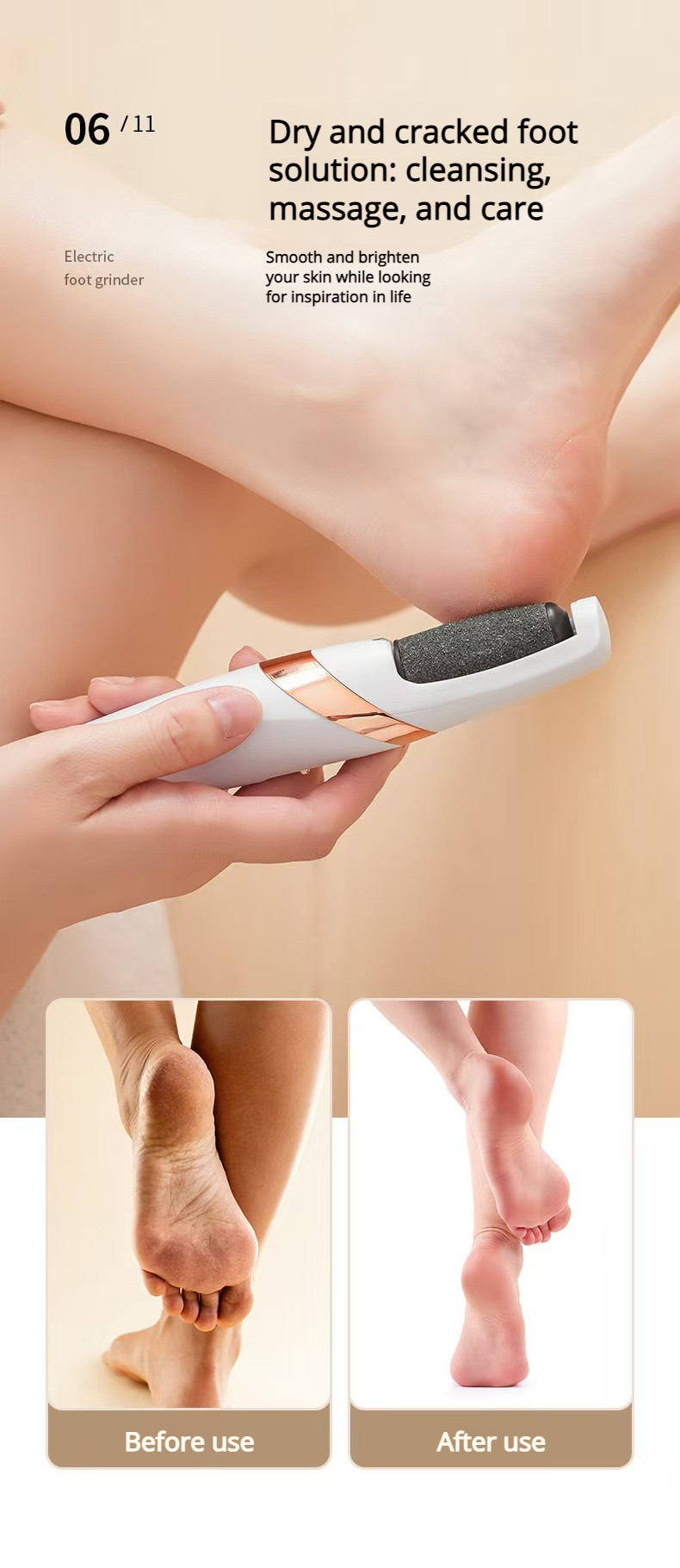 Electric Callus Remover for Feet | Rechargeable Foot File for Dry & Cracked Heels | Professional Pedicure Kit