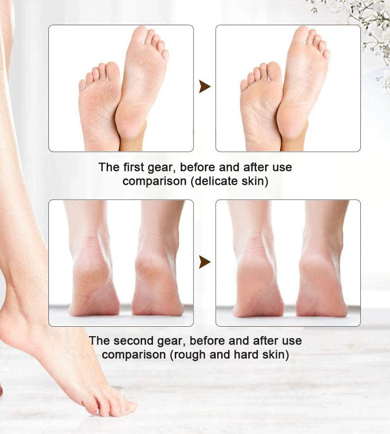 Electric Callus Remover for Feet | Rechargeable Foot File for Dry & Cracked Heels | Professional Pedicure Kit