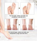 Electric Callus Remover for Feet | Rechargeable Foot File for Dry & Cracked Heels | Professional Pedicure Kit