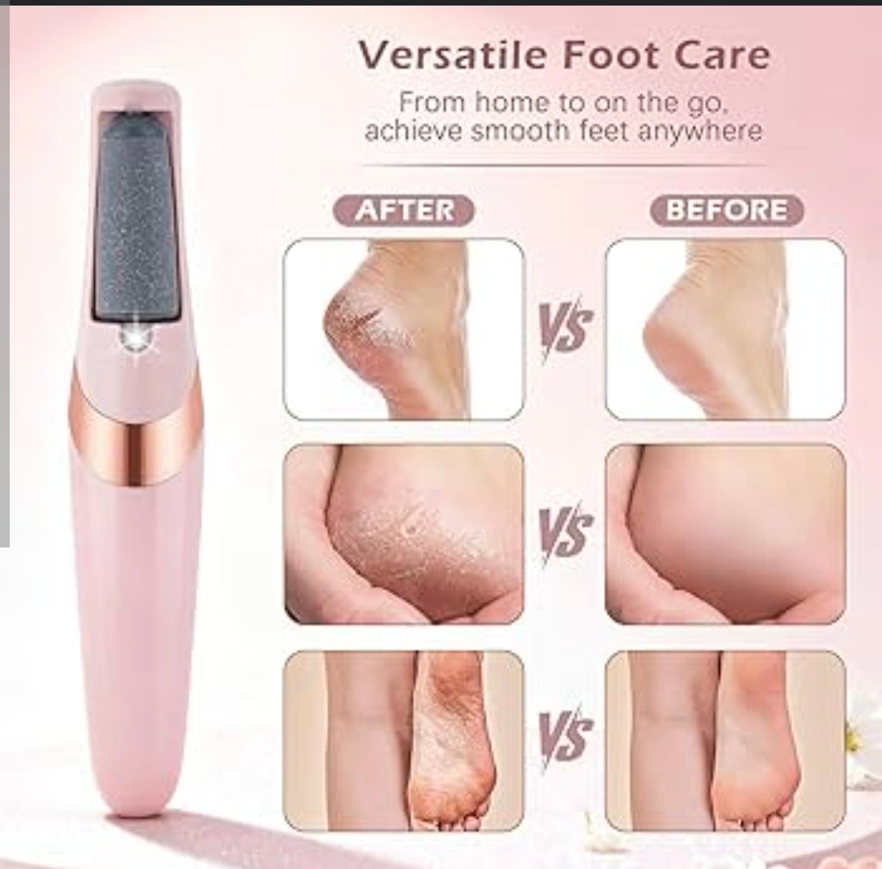 Electric Foot Callus Remover — Rechargeable Pedicure Tool for Silky-Smooth Feet